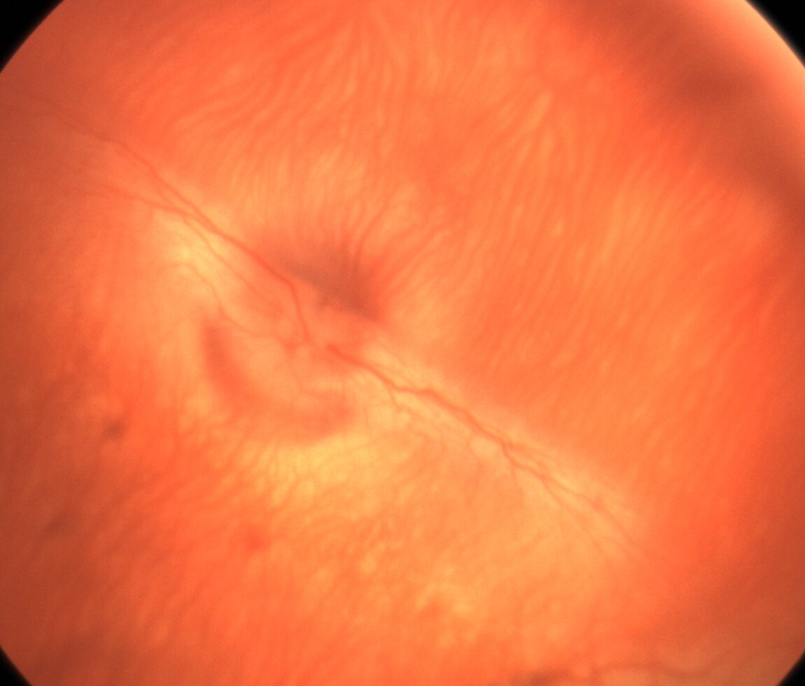 Tavşan fundus görüntüsünde retina damar ağı